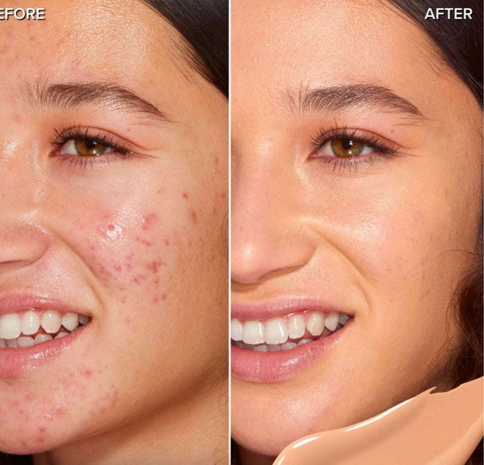 كونسيلر تو فيسد